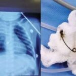 മലയില്‍ കുടുങ്ങിയ ബാബുവിനെ രക്ഷിക്കാന്‍ ചെലവായത് 75 ലക്ഷം;കണക്കുകൾ