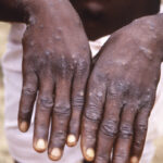 തൃക്കാക്കര ഉപ തെരെഞ്ഞെടുപ്പ്; പണം വാഗ്ദാനം ചെയ്ത സംഭവത്തിൽ കേസെടുത്ത് പൊലീസ്