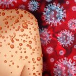 തിരുവനന്തപുരം ന​ഗരസഭയ്ക്ക് ജനറൽ/ എസ്.സി, എസ്.ടി സ്പോർട്സ് ടീമുകൾ,മേയറുടെ പോസ്റ്റിൽ വ്യാപക വിമർശനം