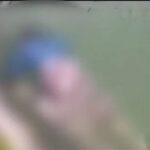 താമരശ്ശേരി പെരുച്ചാഴിയുടെ കടിയേറ്റ് വീട്ടമ്മയുടെ കാലിന്റെ ഞരമ്പ് അറ്റു