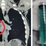 സ്വവർഗ വിവാഹങ്ങൾക്ക് നിയമസാധുത; സുപ്രീംകോടതി വിധി ഈ മാസം