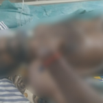 കേബിളില്‍ കുരുങ്ങി വീട്ടമ്മയ്ക്ക് പരിക്കേറ്റ സംഭവം; ലോറി ഡ്രൈവര്‍ അറസ്റ്റില്‍
