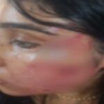 ലോമാസ്റ്റ് ലൈറ്റ് ഉദ്ഘാടനം ചെയ്തു