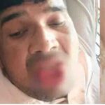 ഒറ്റപ്പെട്ട ശക്തമായ മഴ തുടരും; മലയോര മേഖലകളില്‍ മഴ ശക്തമാകാന്‍ സാധ്യത