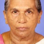 കുന്ദമംഗലത്ത് അർദ്ധരാത്രി വീടിന് നേരെ അജ്ഞാതരുടെ കല്ലേറ്